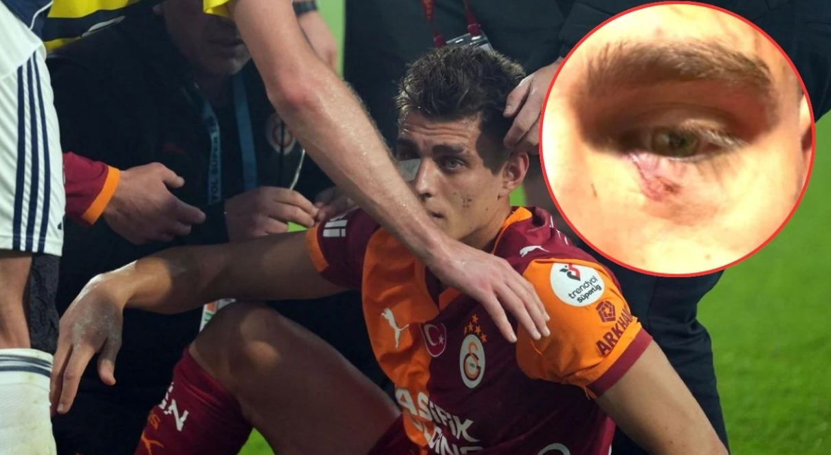 Derbide sahaya çakmak atan taraftar gözaltına alındı