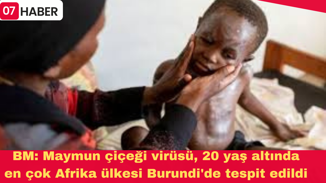 BM: Maymun çiçeği virüsü, 20 yaş altında en çok Afrika ülkesi Burundi'de tespit edildi